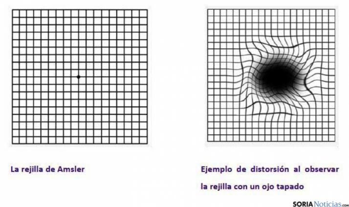 El test con la rejilla de Amsler.