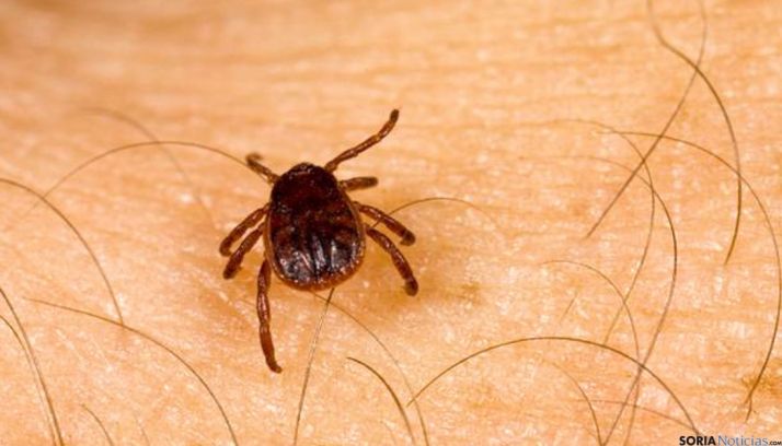 Una garrapata sobre la piel de una persona. / SN