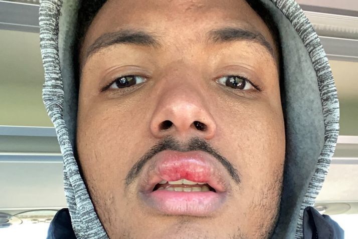 Edipo denuncia insultos racistas en el último partido del Almazán