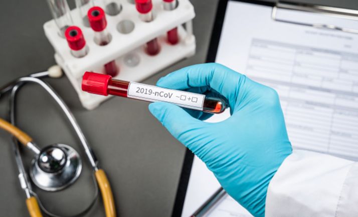 El Santa Bárbara consigue realizar el diagnóstico completo del COVID-19