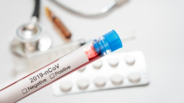 PAMA ofrece a los sorianos la posibilidad de realizarse el test del Coronavirus