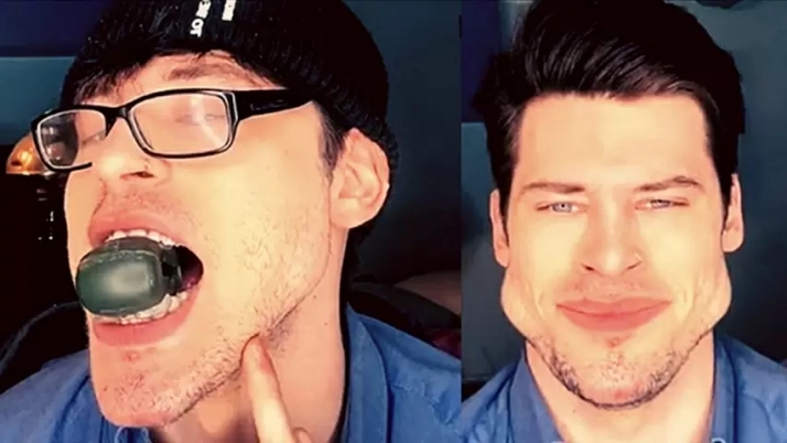 Los dentistas advierten de los riesgos de la última moda en redes sociales