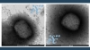 Dos imágenes, obtenidas por microscopía electrónica, del virus de la viruela del mono. /Unidad de Microscopía Electrónica del ISCIII.