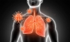 Foto 1 - Revelan el mecanismo que agrava el covid en los pulmones y el camino hacia su tratamiento