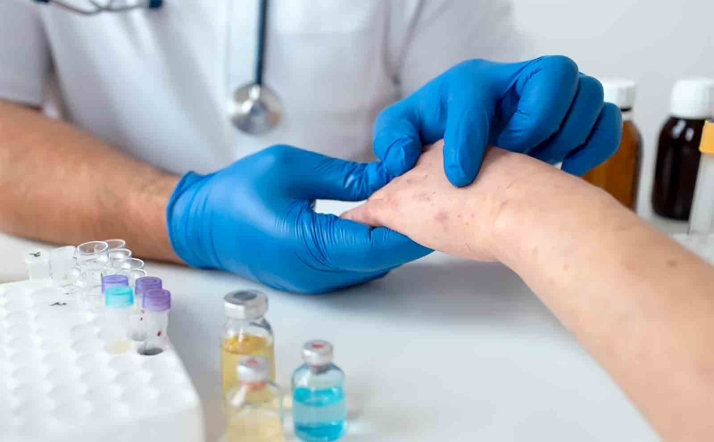 Castilla y León destina 5 M&euro; para la adquisición de vacunas frente al herpes zóster