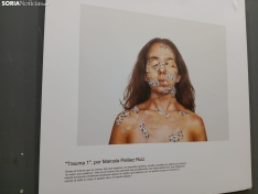 Foto 5 - 'En el objetivo, la salud mental': Fotografías de la realidad sin filtros