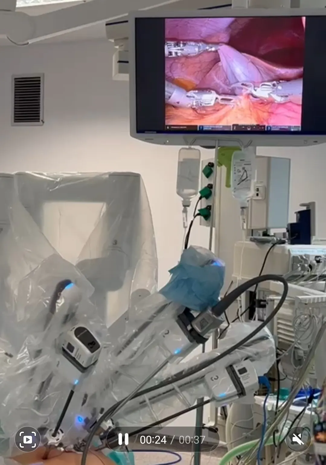 Foto 2 - Los profesionales del Hospital Santa B&aacute;rbara de Soria realizan las primeras cirug&iacute;as con el robot Da Vinci