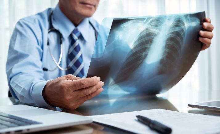 Las infecciones respiratorias repuntan hasta los 904 casos pese a mantenerse en un nivel de intensidad bajo