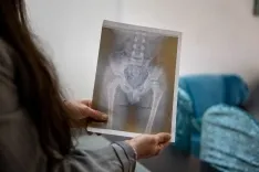 Foto 3 - 10.000 firmas para que el Perthes deje de "robar infancias": la lucha de Aren y su familia