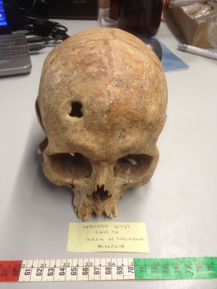 El saber m&eacute;dico en la Soria alto-medieval | Imagen 3